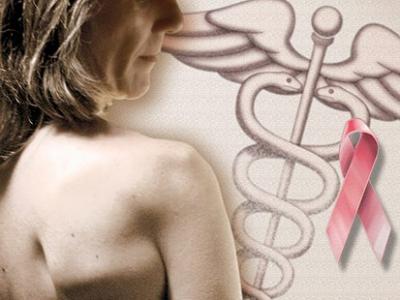 El diagnóstico precoz del cáncer de mama reduce las muertes un 2% cada año