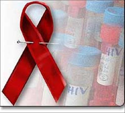 El VIH, un virus incurable